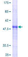 Human TIP30 / HTATIP2 Protein (Recombinant GST)