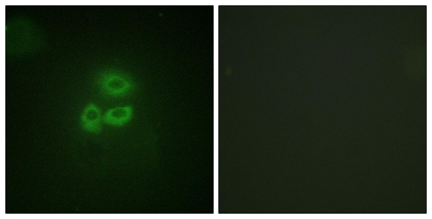 PRKD1 / PKC Mu Antibody (p205)
