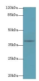 NAT2 Antibody