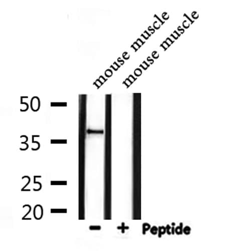 Polyclonal Rabbit anti-Human DOK4 Antibody (IF, WB)