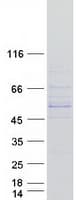 Human CYP11B1 Protein (Recombinant Myc-DDK (Flag))