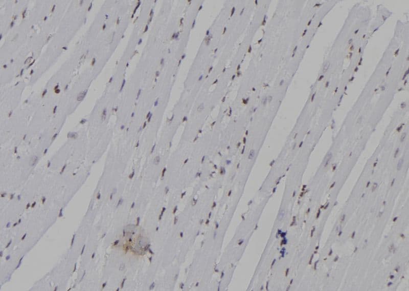 NEUROG3 / NGN3 / Neurogenin 3 Antibody