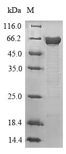 Mouse MAPT / Tau Protein (Recombinant 6His, N-terminus)