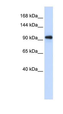 Polyclonal Rabbit anti-Human EXOSC10 Antibody (aa756-805, IHC, WB)