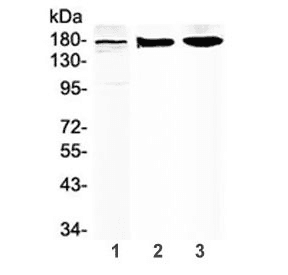 ABCC8 / SUR1 Antibody