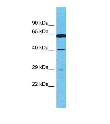 OR4E2 Antibody (C-Terminus)