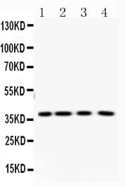 Polyclonal Rabbit anti-Human PNP / Nucleoside Phosphorylase Antibody (IHC, WB)