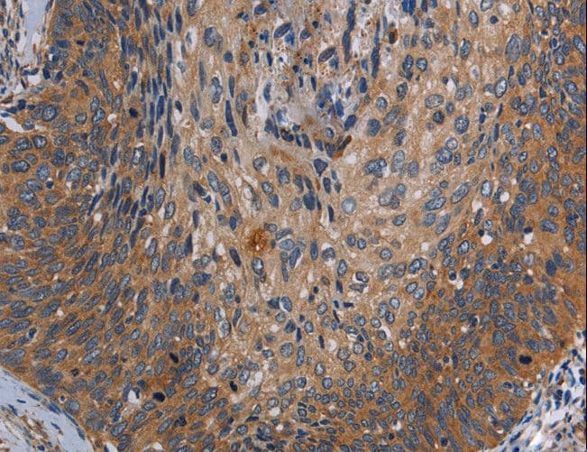 PARP10 Antibody