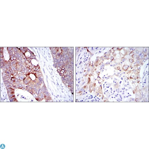 KRT19 / CK19 / Cytokeratin 19 Antibody