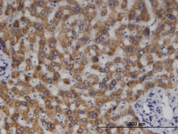 MCCC2 / MCCB Antibody (clone 2B3)