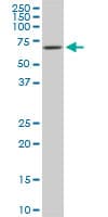 Monoclonal Mouse anti-Human RICK / RIP2 Antibody (clone 3D9, WB)