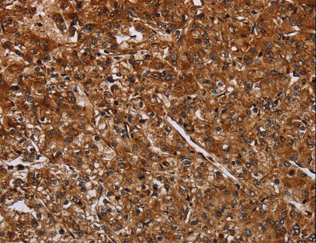 ACP6 Antibody