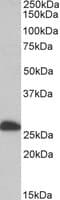 IHC-plus™ ETFB Antibody (aa152-165)