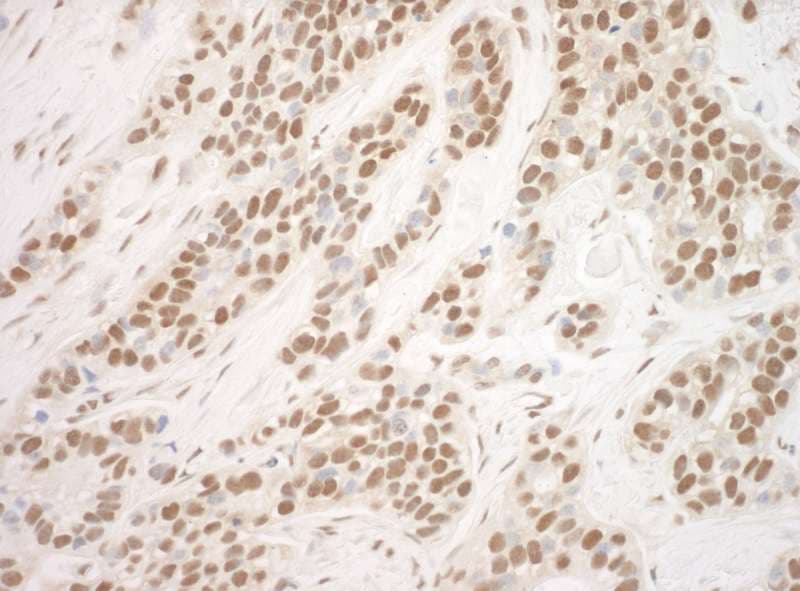 Polyclonal Rabbit anti-Human POGZ Antibody (aa1360-1410, IHC)