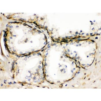 TRPM5 Antibody (aa1021-1108)
