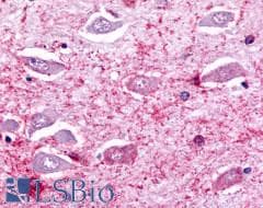 PathPlus™ Polyclonal Rabbit anti-Human TPRA1 / GPR175 Antibody (N-Terminus, IHC)