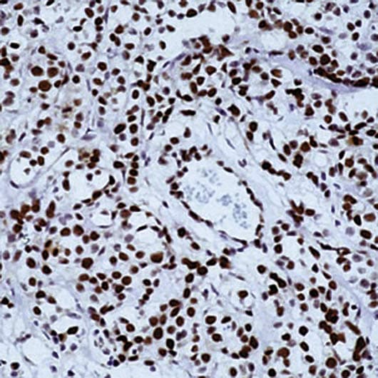 Monoclonal Mouse anti-Human RB1 / Retinoblastoma / RB Antibody (clone 1F8, IHC, WB)