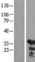 SGTA / SGT Protein (Over-Expression Lysate Myc-DDK (Flag))