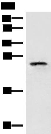 EIF3K Antibody
