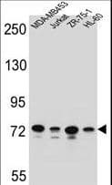 PCDHB15 Antibody (aa113-140)