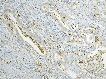 ANXA3 / Annexin A3 Antibody