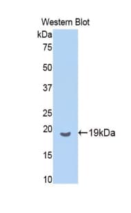 PathPlus™ AIF1 / IBA1 Antibody (aa1-147)