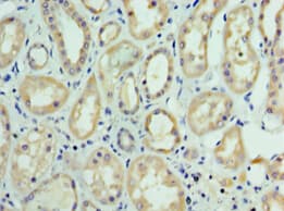 Polyclonal Rabbit anti-Human FUT6 Antibody (aa170-359, IHC, WB)