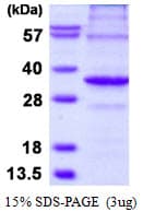 Human APIP Protein (Recombinant His)