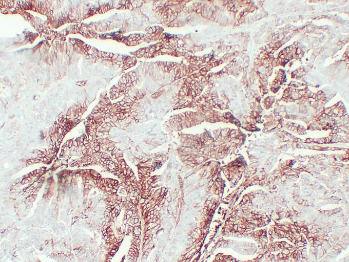 SLC2A1 / GLUT-1 Antibody (clone ABT-GLUT1)