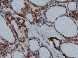 IVD Antibody (clone OTI1B10)