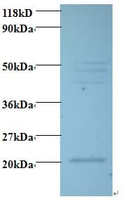 IHC-plus™ VEGFC Antibody