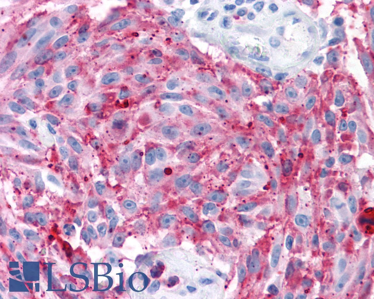 PathPlus™ MRGD / MRGPRD Antibody (Extracellular Domain)