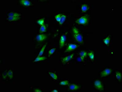 LTBR Antibody