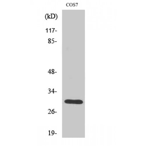HCCS Antibody (50-130 aa, Internal)
