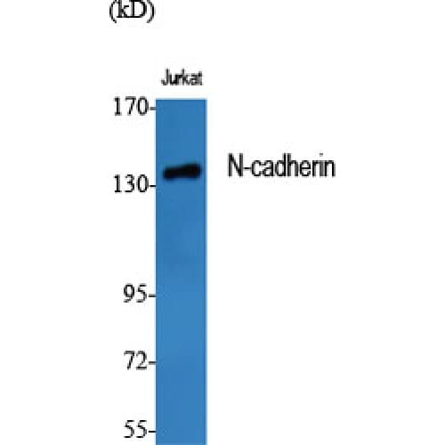 CDH2 / N Cadherin Antibody (690-770 aa, C-terminal)