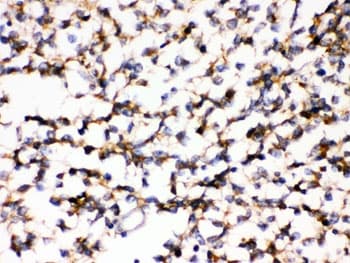 Polyclonal Rabbit anti-Human KCNIP2 / KCHIP2 Antibody (IHC, WB)