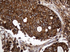 Monoclonal Mouse anti-Human TAPBPL / TAPBPR Antibody (clone OTI3D8, IHC, WB)