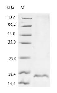 Calloselasma rhodostoma SLYB Protein (Recombinant 6His, N-terminus)