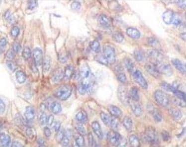 IGF1R / IGF1 Receptor Antibody (clone 3C8B1)