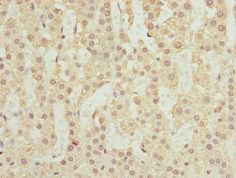 Polyclonal Rabbit anti-Human RUFY2 Antibody (IHC, WB)