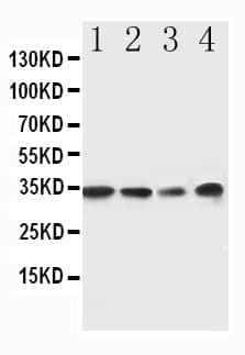 Polyclonal Rabbit anti-Human MYD88 Antibody (aa174-188, IHC, WB)