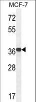 GPD1L Antibody (aa44-73)