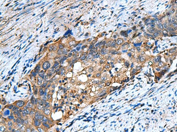 COMMD9 Antibody