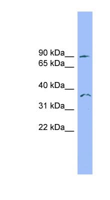 SDCCAG8 Antibody (aa107-156)
