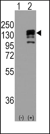 Polyclonal Rabbit anti-Human CDH1 / E Cadherin Antibody (aa160-189, WB)