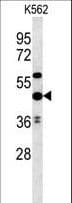 Polyclonal Rabbit anti-Human UBAC1 / KPC2 Antibody (aa264-292, IHC, WB)