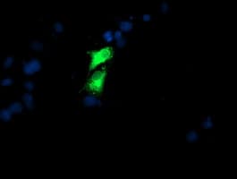 GOLM1 / GP73 / GOLPH2 Antibody (clone OTI4B12)