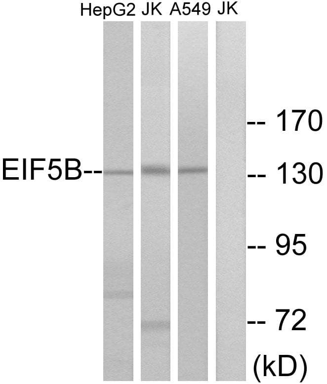 Polyclonal Rabbit anti-Human EIF5B / IF2 Antibody (WB)