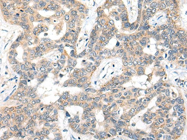 SNX6 Antibody