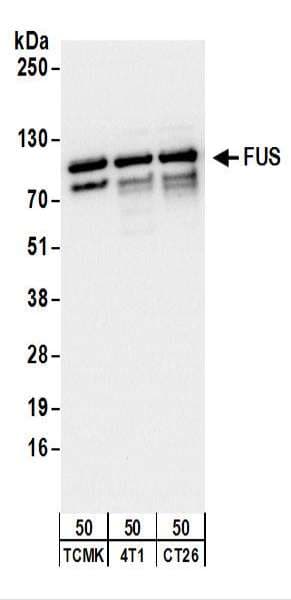 Polyclonal Rabbit anti-Human FUS / TLS Antibody (aa400-450, IHC, WB)